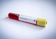 Corona Virus: 14 Day Isolation or Return to your Country Corona Virus